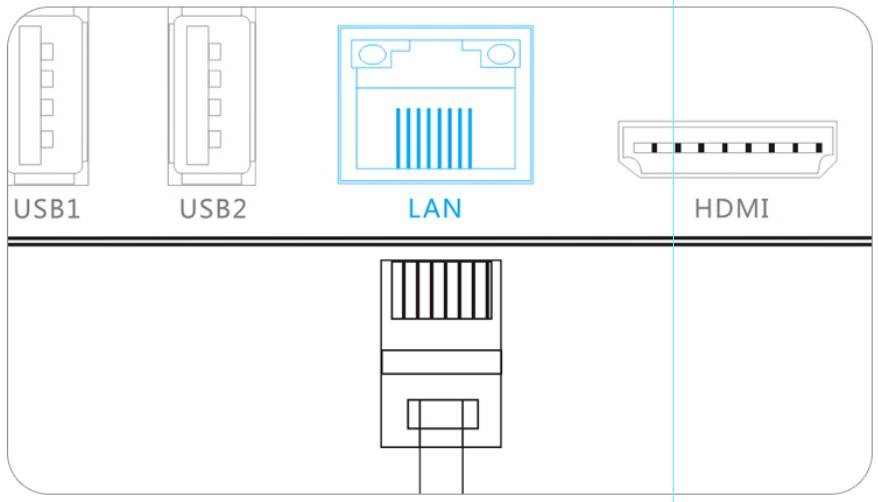 网络机顶盒怎么安装使用 网络机顶盒安装步骤和使用方法 
