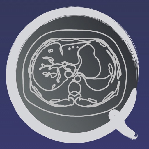 CT护照测验"腹部"/剖面解剖/MRI