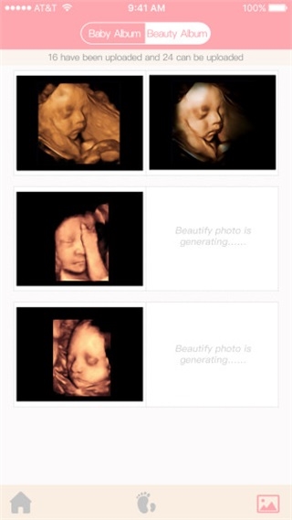胎儿相机图片1